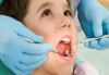Sâu răng ở trẻ em nguyên nhân, dấu hiệu nhận biết, tác hại, cách điều trị và phòng ngừa
