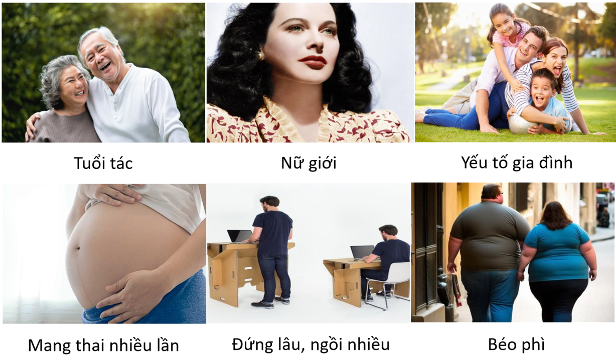 Các yếu tố nguy cơ của suy tĩnh mạch chi dưới