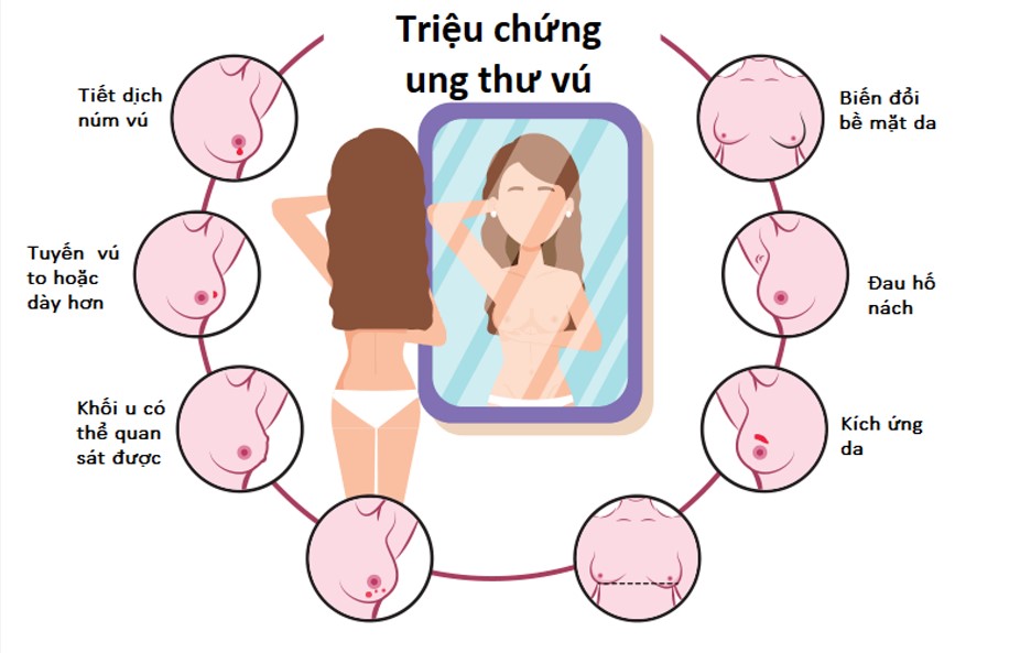 Hình 1: Những dấu hiệu nhận biết ung thư vú